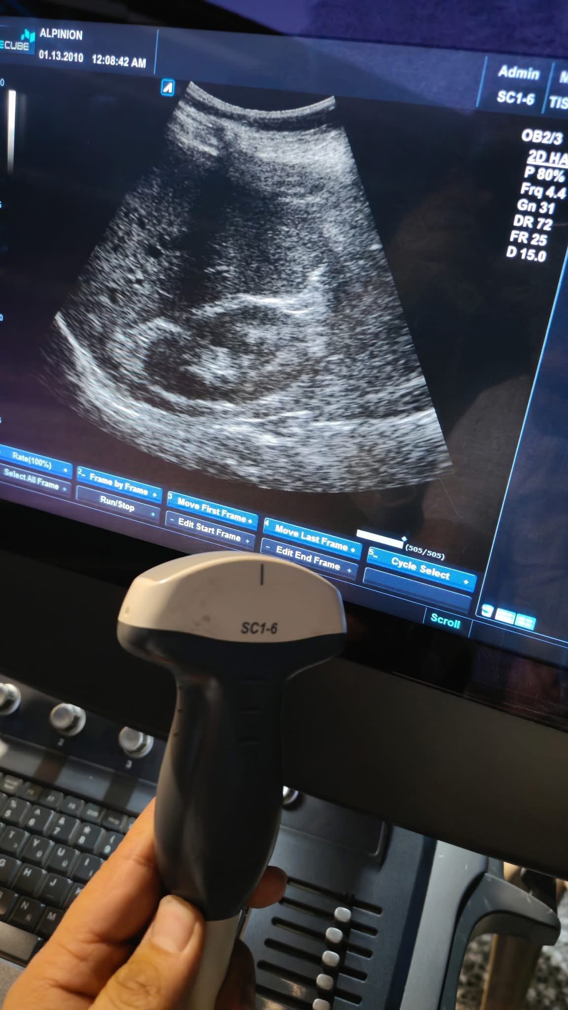 صورة إضافية